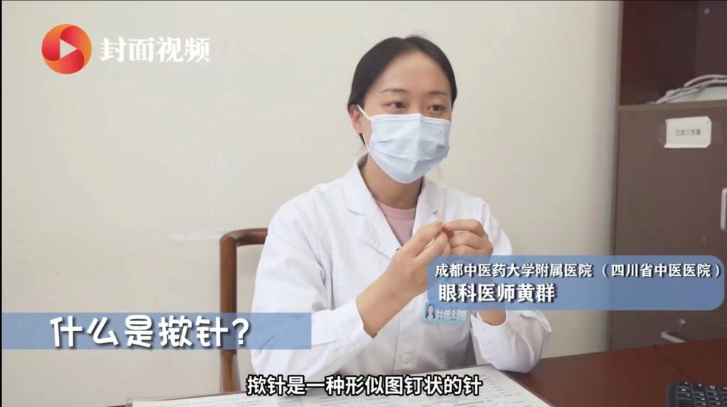 特色療灋(fa)：揿針
